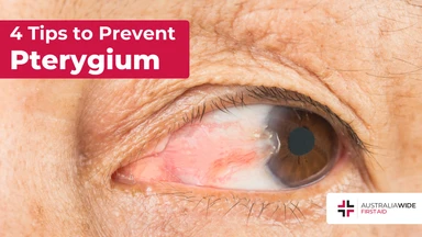 Prevent pterygium article header – First Aid Article in Bendigo